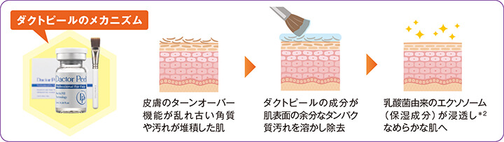 メカニズム