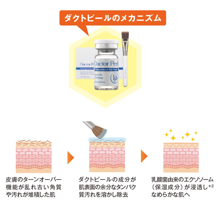 メカニズム